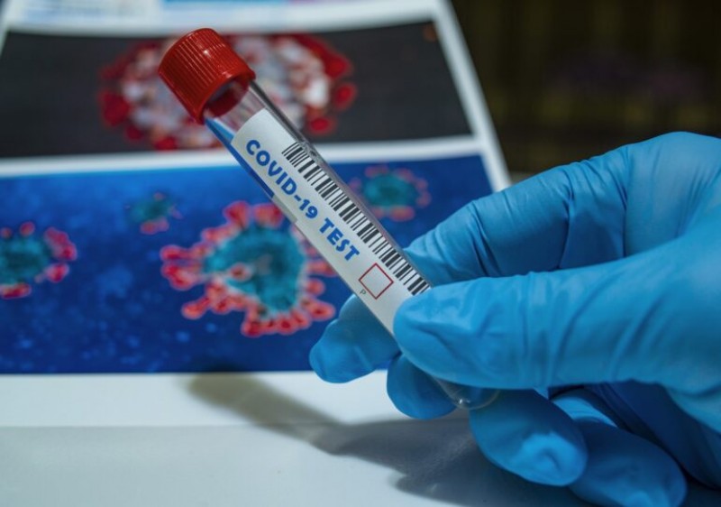 78 de noi infectări cu Coronavirus, raportate de autoritățile sanitare