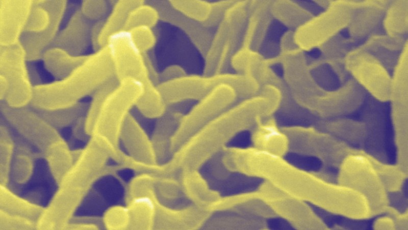 Ce spune Ministerul Sănătății, după ce o tulpină a bacteriei care provoacă holera a fost descoperită în Republica Moldova