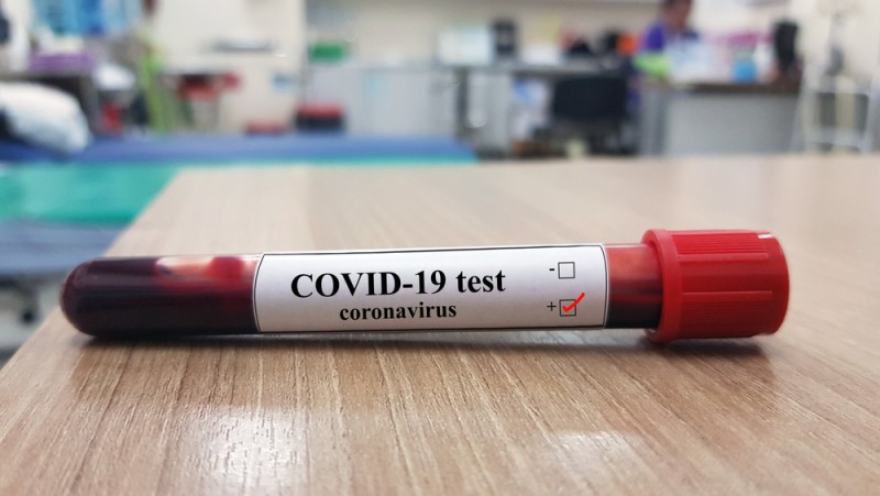 Coronavirus. Patru comune în scenariu „roșu”. Municipiul Botoșani, la un pas de a atinge pragul critic