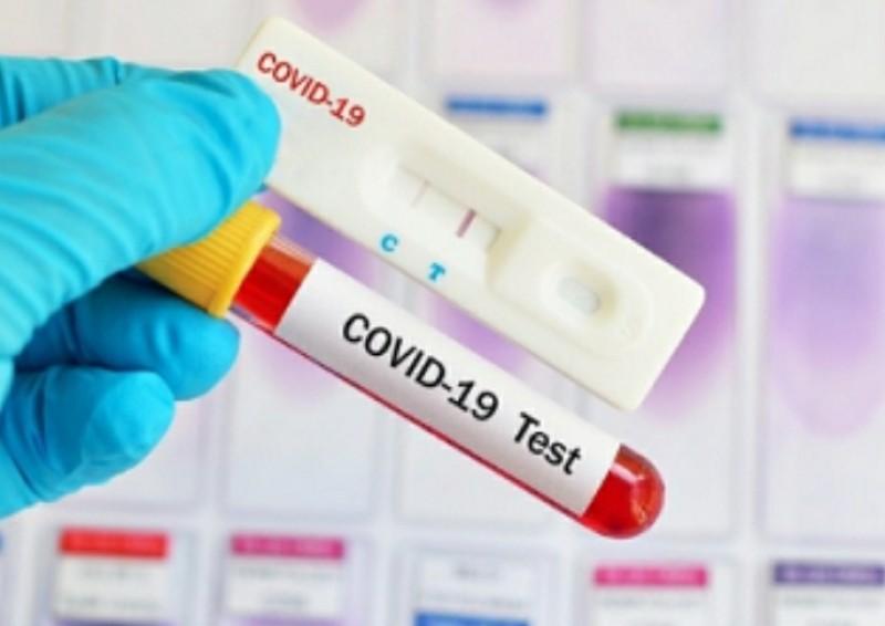 DSP:Șase cazuri noi de infectare cu Covid-19, din peste 280 de teste 