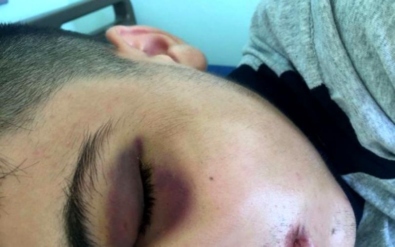 Elev bătut în stația de microbuz de doi tineri. Bătăușii au fost reținuți de polițiștii din Iași, pentru săvârșirea mai multor fapte de furt 