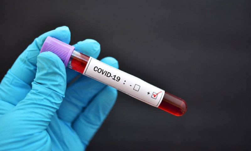 Statistică: 646 persoane au fost testate pozitiv cu Covid-19 de la începutul epidemiei la Botoșani. Aproape jumătate au fost tratați