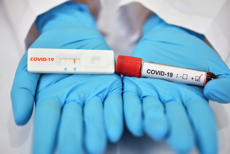 Testele rapide pentru depistarea COVID nu mai pot fi vândute în farmacii