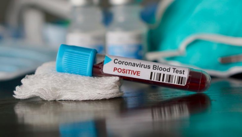 Un singur caz nou de infectare cu COVID în Botoșani