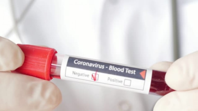 Val de botoșăneni vindecați de coronavirus. Alte 135 de infectări raportate și încă un deces